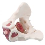 Erler Zimmer Male Pelvis with Pelvic Floor Musculature