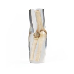 Erler Zimmer X-ray Phantom Elbow (Transparent)