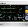 T1 Transport Patient Monitor w/ Masimo SET SpO2, ST/Arrhythmia Analysis & 12 Lead ECG