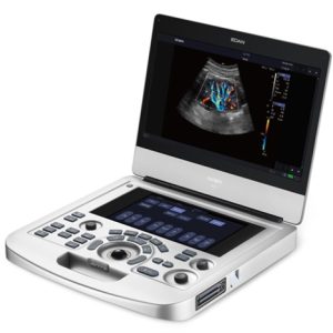 Edan Acclarix AX2 Diagnostic Ultrasound System