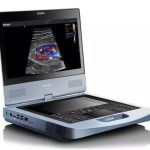 Edan Acclarix AX7 Ultrasound (128 Channels)