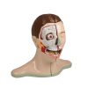 Erler Zimmer Head and Neck (5-part)