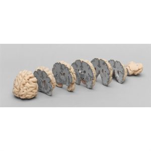 Erler Zimmer Human Brain Multiple Frontal Sections