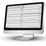 Central Station Software For 4 Fetal Monitors