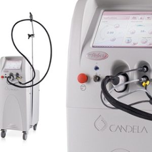 Candela VBeam Perfecta Includes New Dye Kit Professional Installation