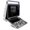 Chison Ebit 30 Diagnostic Ultrasound System