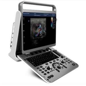 Chison Ebit 30 Diagnostic Ultrasound System