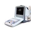 Chison Ultrasound Scanner Linear Probe Muskuloskeletal Diagnosis 9300 MSK