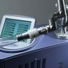 Cynosure RevLite SI Q-Switched Tattoo Removal