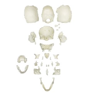 Erler Zimmer Disarticulated Human Medical Study Skull