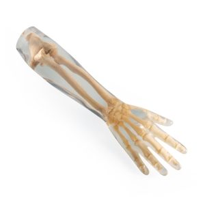 Erler Zimmer X-ray Phantom Lower Arm (Transparent)