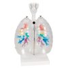 3B Scientific CT Bronchial Tree Model with Larynx & Transparent Lungs Smart Anatomy