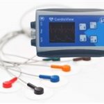 BioSigns CardioView HW9E-H Holter System (w/1-yr Software License)