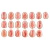 Erler Zimmer Vulva - Casts Showing Antomical Differences