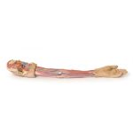 Erler Zimmer Upper Limb