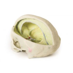 Erler Zimmer Dural Skull