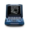 Sonosite Micromaxx Portable Ultrasound Machine - MSK (Refurbished)
