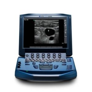 Sonosite Micromaxx Portable Ultrasound Machine - MSK (Refurbished)