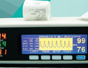 Desktop Pulse Oximeter with Graphic Display, NIBP