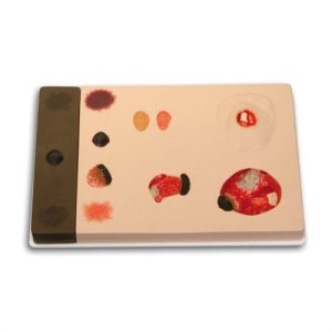 Erler Zimmer Pat Pressure Injury Model