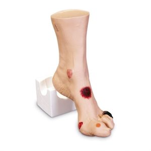 Erler Zimmer Wound Foot 'WILMA'