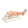 Erler Zimmer Annie Arterial Insufficiency Leg
