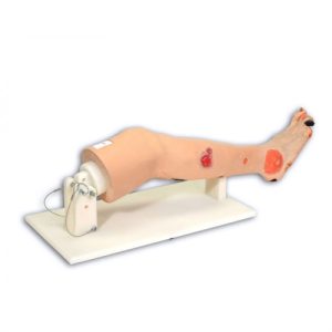 Erler Zimmer Annie Arterial Insufficiency Leg