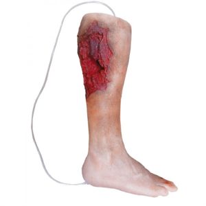 Erler Zimmer Emergency Lower Leg