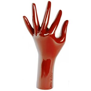 RSD Anthropomorphic Hand/Wrist Phantom (Oblique Position)