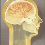 RSD Half Angiographic Head Phantom with Step Wedge