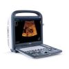 Sonoscape S2 Portable Color Doppler Ultrasound System