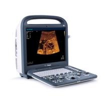 Sonoscape S2 Portable Color Doppler Ultrasound System