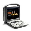 Sonoscape S6 Portable Color Doppler System (MSK)