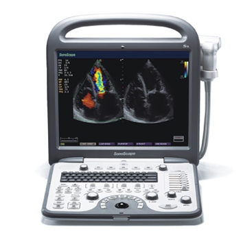 Sonoscape 3D CW Color Doppler Cardiac Basic Echo 1 Sonoscape 3D CW Color Doppler Cardiac Basic Echo