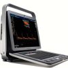Sonoscape 3D CW Color Doppler Cardiac & Echo