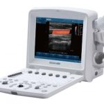 Edan U50 Prime Color Ultrasound (MSK)