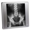 Techno-Aide LED X-Ray Radiology Viewbox with Dimmer and Film Activating Switch