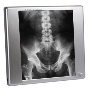 Techno-Aide LED X-Ray Radiology Viewbox with Dimmer and Film Activating Switch