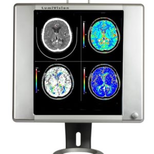 Techno-Aide LED X-Ray Radiology Viewbox with Grip and Stand