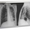 Techno-Aide LED X-Ray Radiology Double Bank Viewbox Illuminator with Dimmer and Film Activated Switches