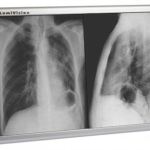 Techno-Aide LED X-Ray Radiology Double Bank Viewbox Illuminator with Dimmer and Film Activated Switches