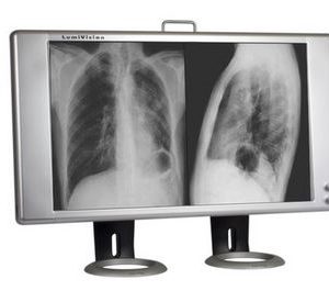 Techno-Aide LED X-Ray Radiology Double Bank Viewbox Illuminator with Stand, Handle, Dimmer and Film Activated Switches