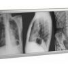 Techno-Aide LED X-Ray Radiology Three Bank Viewbox Illuminator with Dimmer and Film Activated Switches