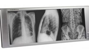 Techno-Aide LED X-Ray Radiology Three Bank Viewbox Illuminator with Dimmer and Film Activated Switches