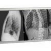 Techno-Aide LED X-Ray Radiology Four Bank Viewbox Illuminator with Dimmer and Film Activated Switches