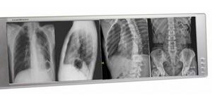 Techno-Aide LED X-Ray Radiology Four Bank Viewbox Illuminator with Dimmer and Film Activated Switches