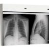 Techno-Aide Two Bank X-Ray Radiology Viewbox Illuminator with Film Activated Switch