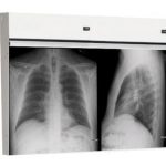 Techno-Aide Two Bank X-Ray Radiology Viewbox Illuminator with Film Activated Switch