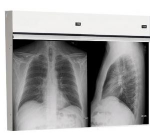 Techno-Aide Two Bank X-Ray Radiology Viewbox Illuminator with Film Activated Switch