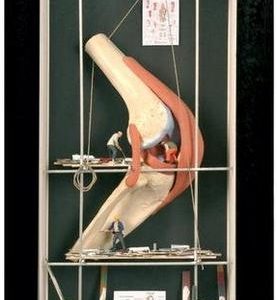 Knee in a Wall Display